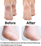 Electric Foot Callus Remover